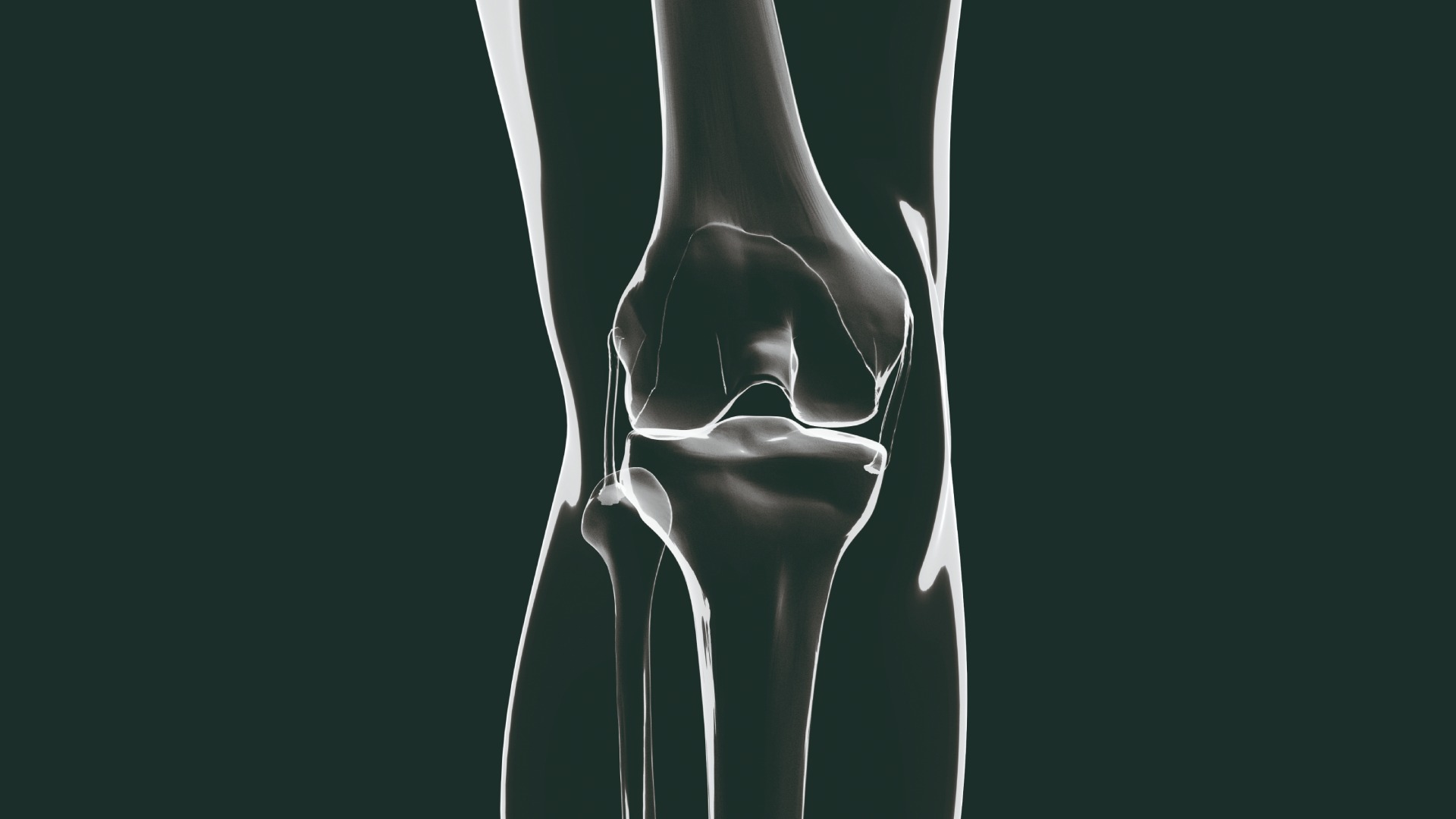 Knee+ / NexSight — official manufacturer image